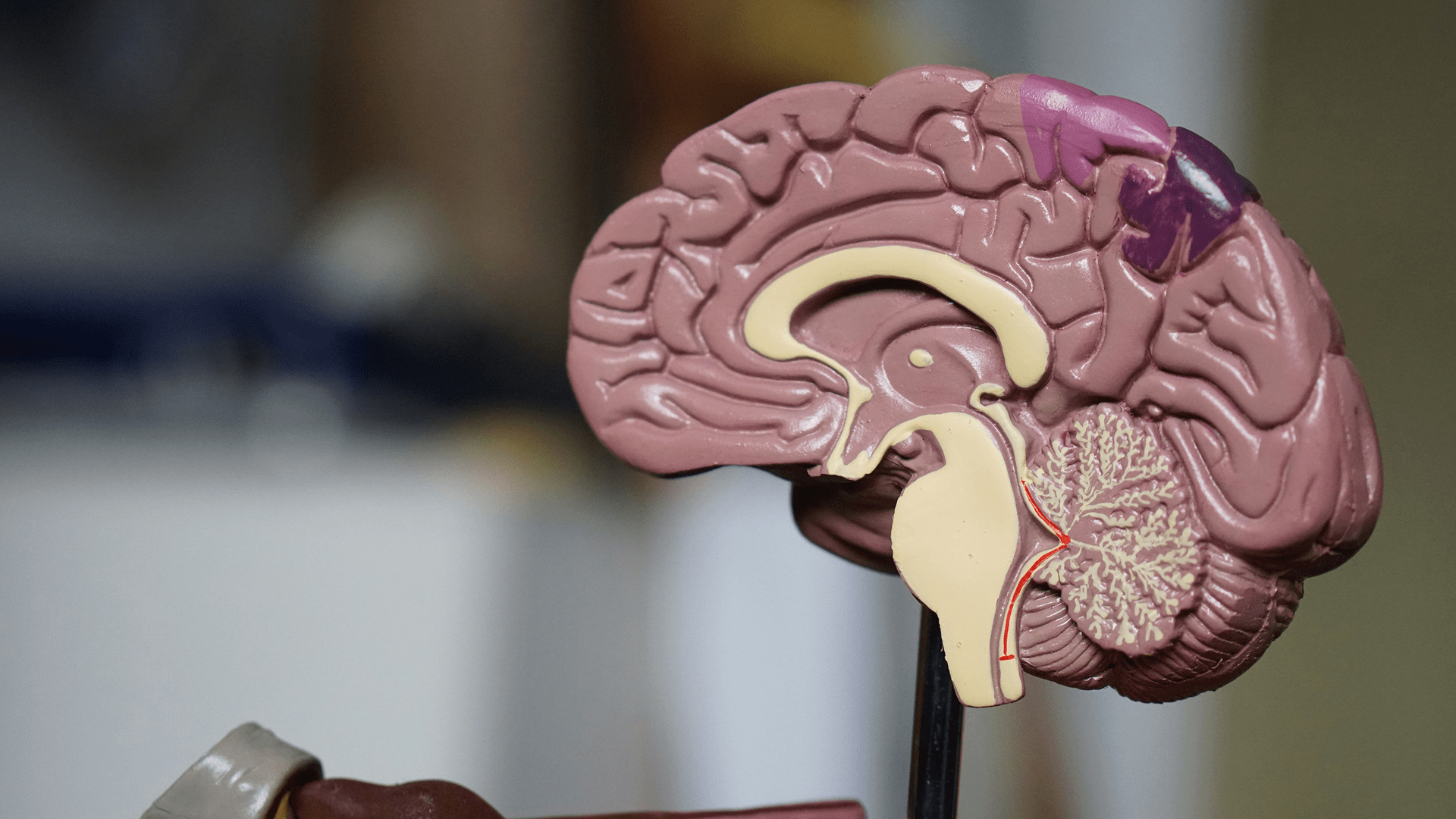 Was ist Neuromarketing einfach erklärt?